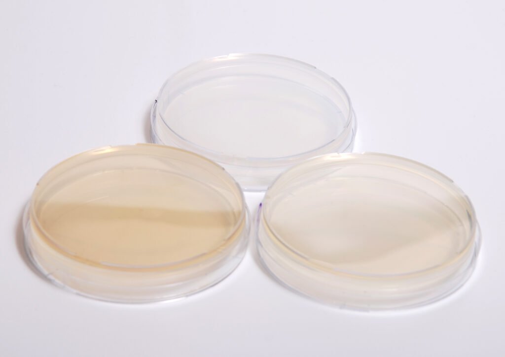 Four culture plates of different media arranged on a pale bench surface.