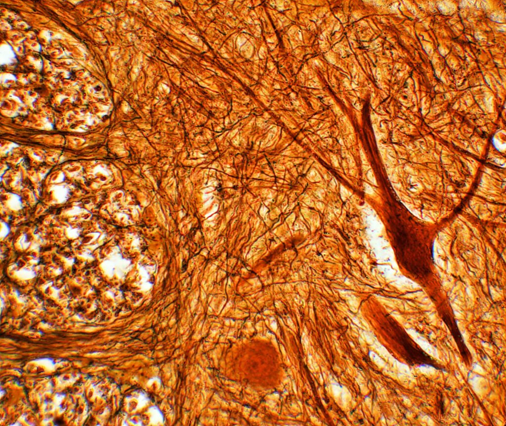 A silver-stained neural tissue section photographed at high magnification, processes branching across the field.